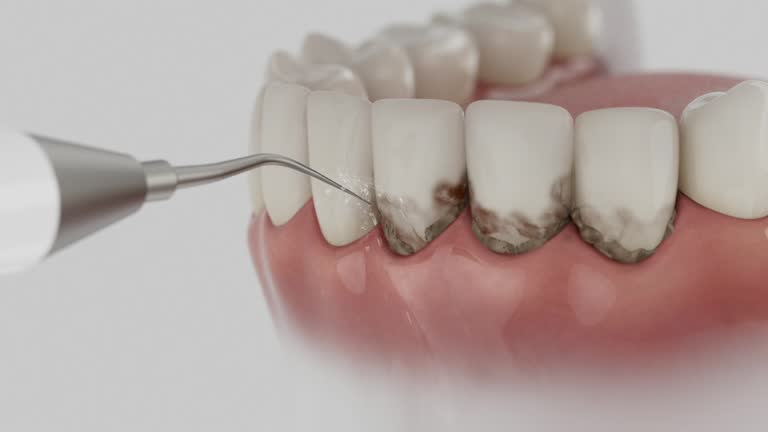 Reliable Teeth Cleaning And Checkup contractor in Huron County County, MI by Dentist Open Now
